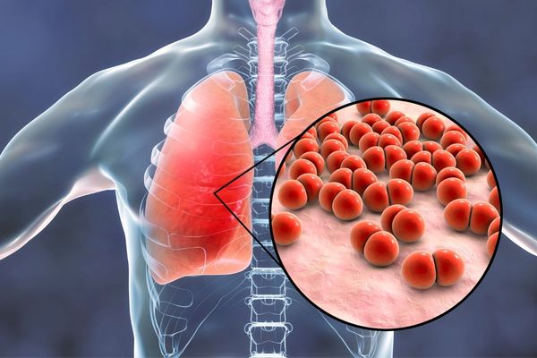 Xray image of a pair of lungs with red magnified cells for World Pneumonia Day