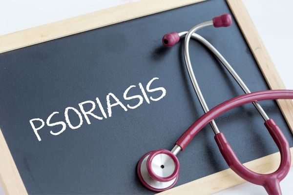 The word "Psoriasis" written in white chalk on a blackboard with a stethoscope for World Psoriasis Day