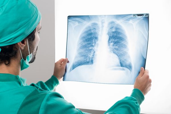 Radiographer looking at an image of lungs for World Radiography Day